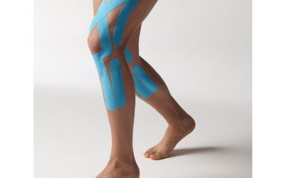 ¿Funciona el kinesiotape?