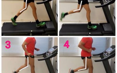 Dolor de rodilla en corredores, posibles causas…